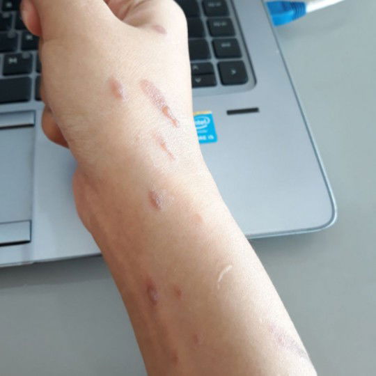 kecipratan minyak saat goreng