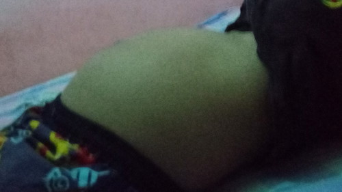 อาการแบบนี้คืออะไรคะ ?