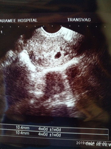 ขอกำลังใจหน่อยค่ะ