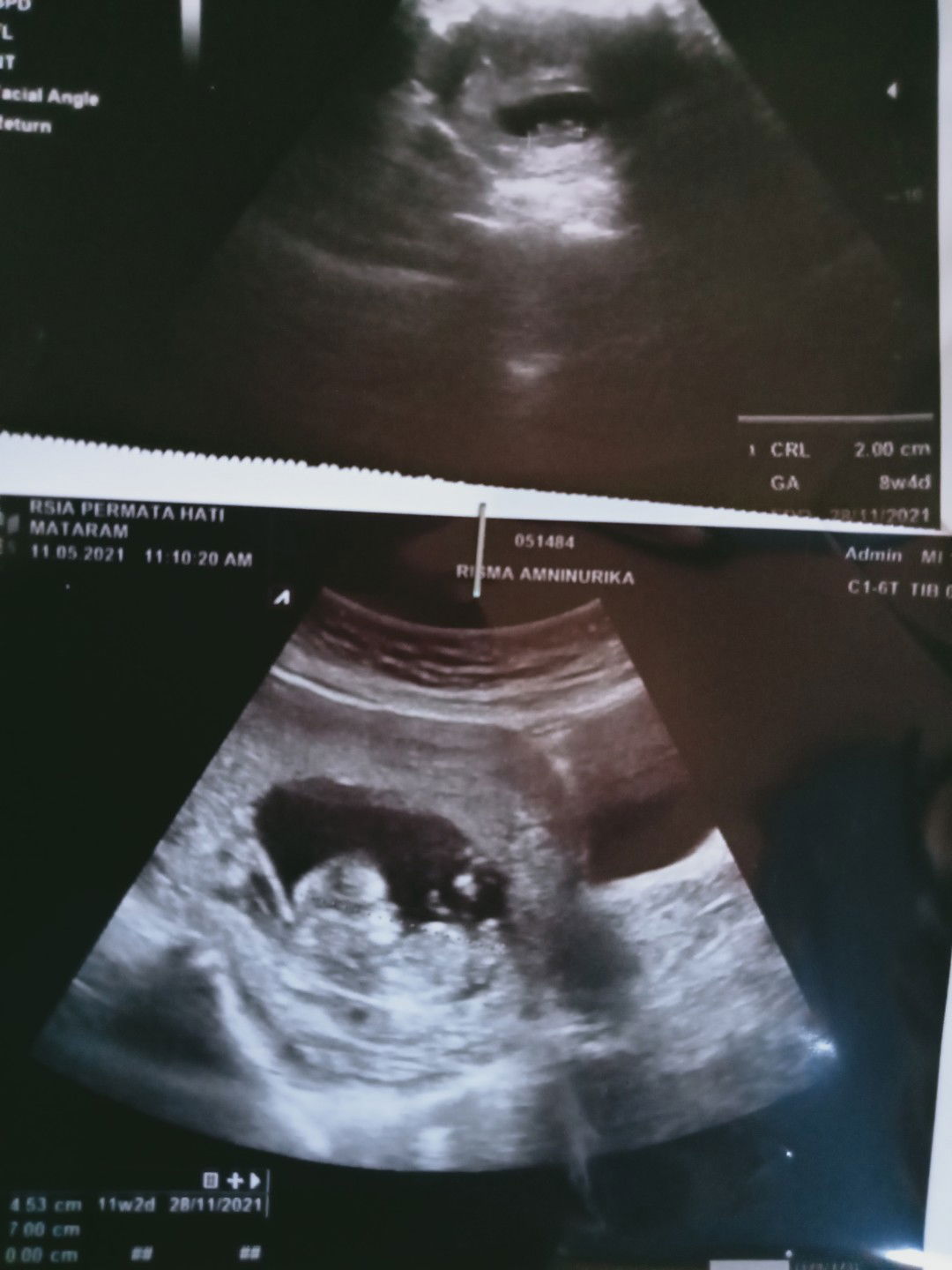 Nyoman Aprilliona rima profile icon