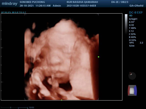 Beymie Junior profile icon