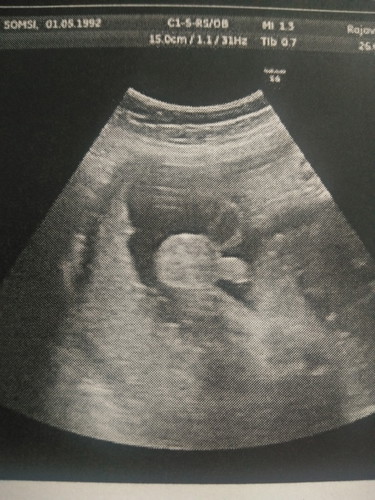 นอยด์ค่ะ