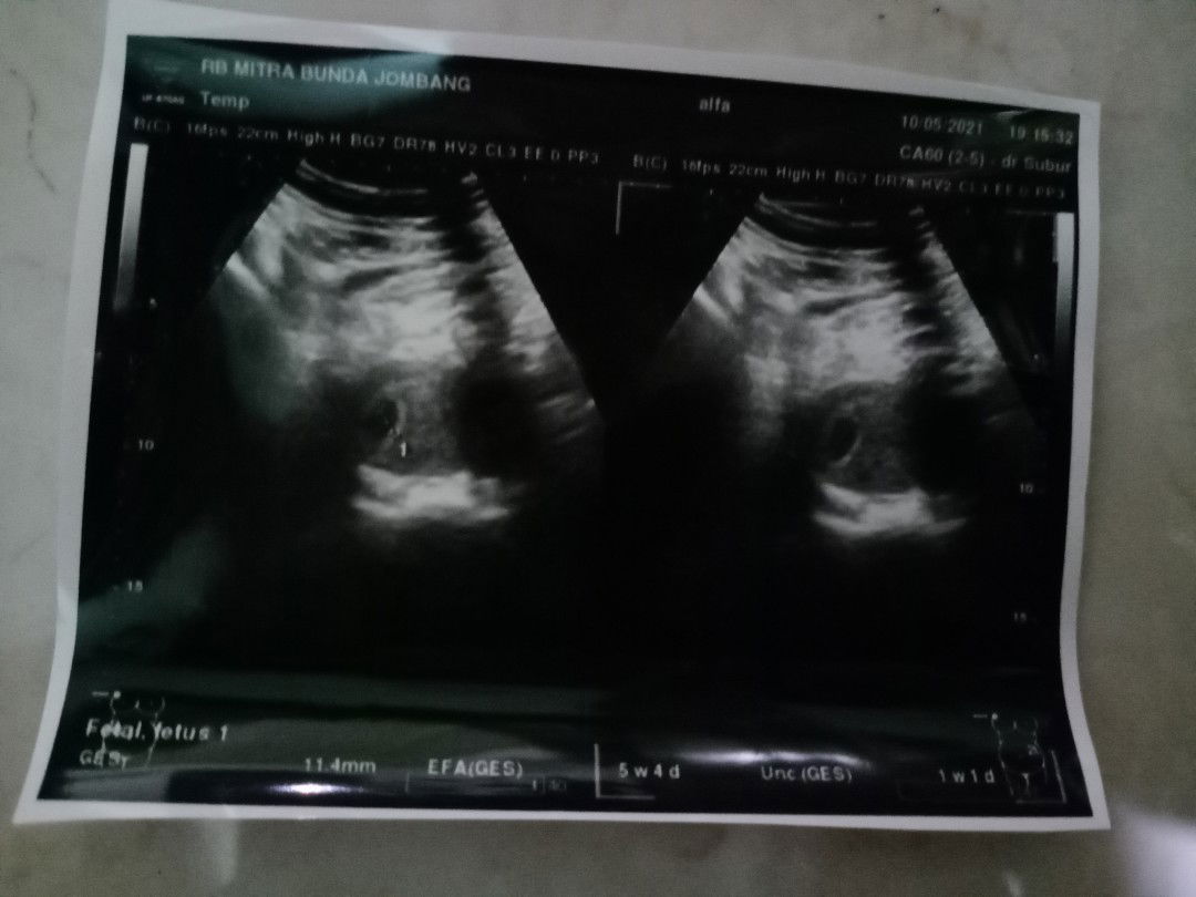 Alfa Nur Ulumi Dinana profile icon