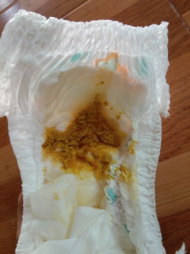 อุจจาระแบบนี้น้องท้องเสียไหมคะ