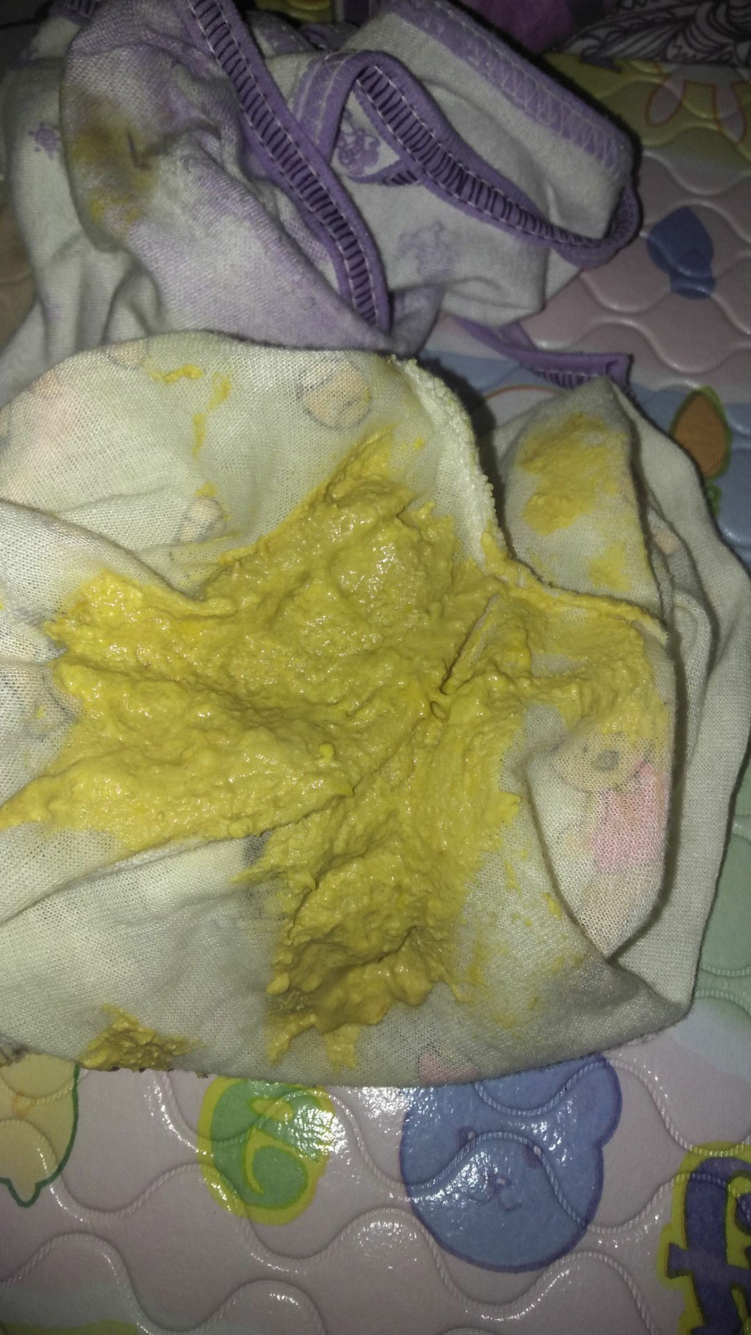 BAB anak usia 1 Bulan 21 Hari