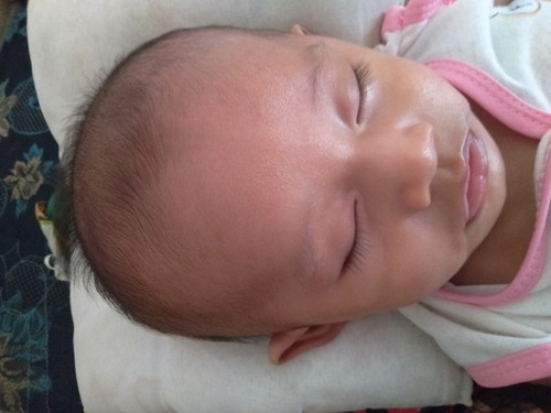 bentuk kepala bayi