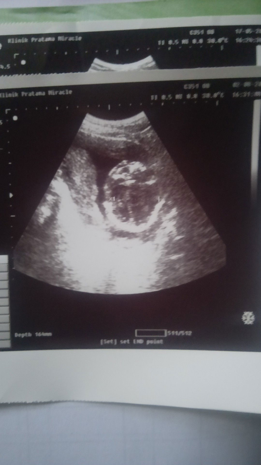 Sri Hartini rahayu profile icon