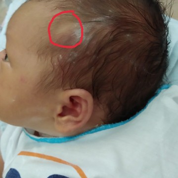 ผมลูก