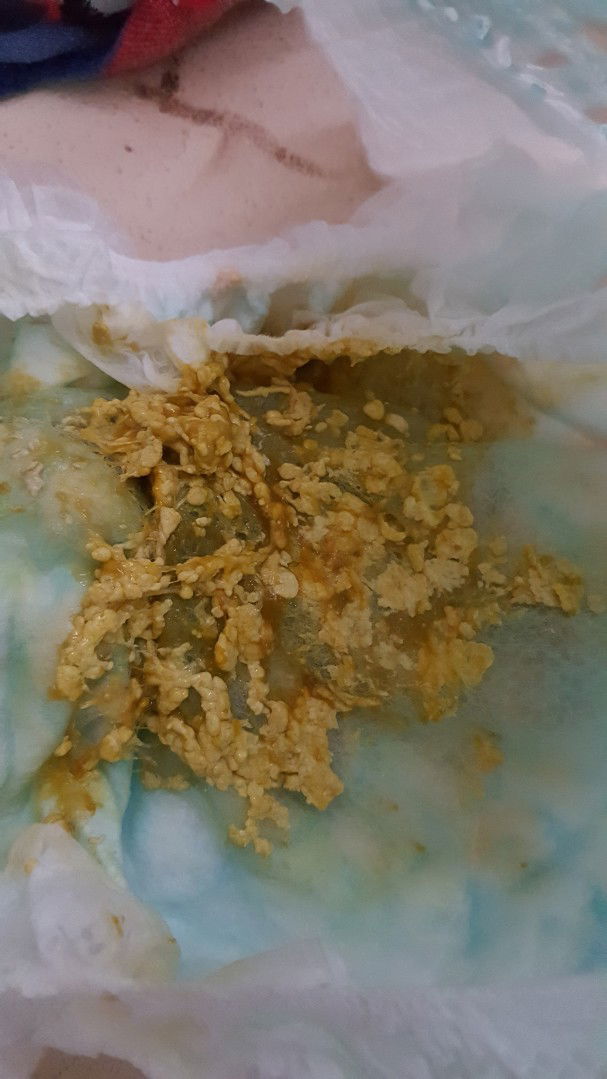 galing sa pag dadadiarrhea