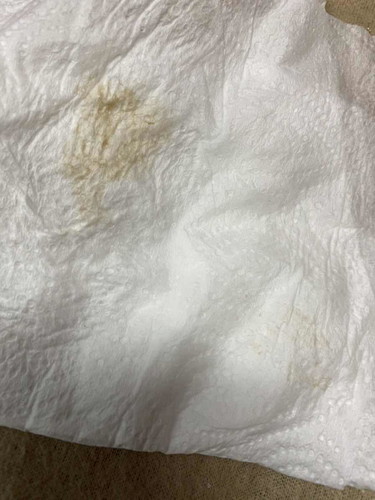 ตั้งครรภ์ได้5สัปดาห์ค่ะมีสีน้ำตาลออกมาแบบนี้อันตรายมั้ยค่ะ