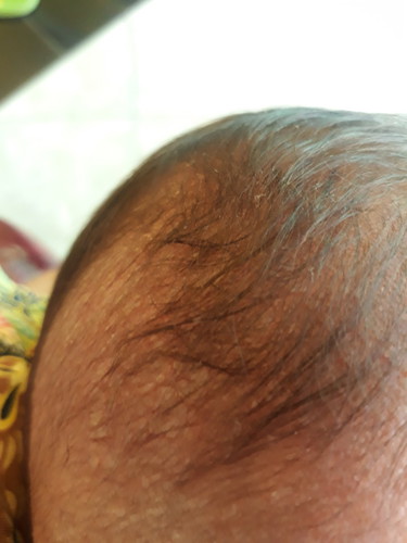 kepala bayi