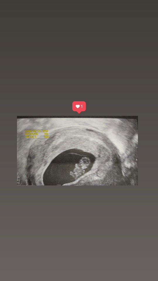 Appie Sarmiento profile icon