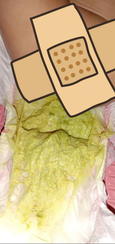 sawan daw? worrried mom..