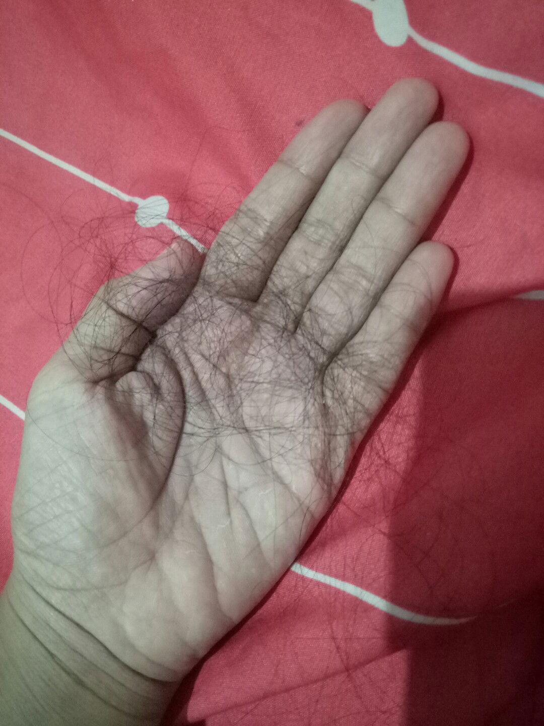 rambut rontok saat menyusui