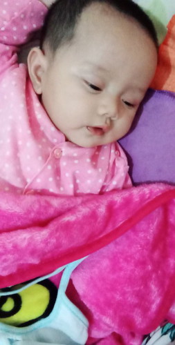 tidur dengan mata terbuka,btw anting nya ditarik baby sotoy ini barusan sampe luka dan nangis jerit❤️#masyaallah