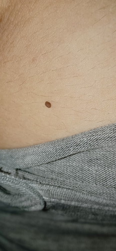 kutil atau apa? mohon info dan solusinya