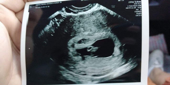 Angel Umali profile icon