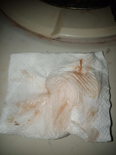 เลือดออก