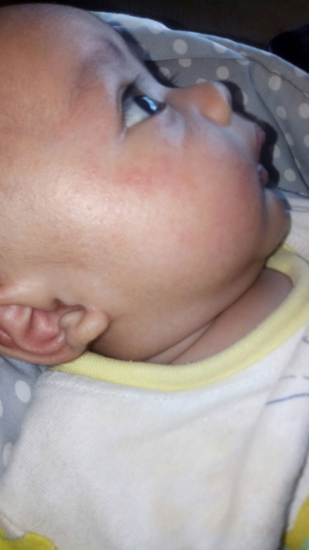 bintik merah di wajah