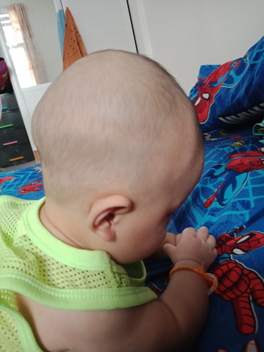 หัวแบนมั้ย