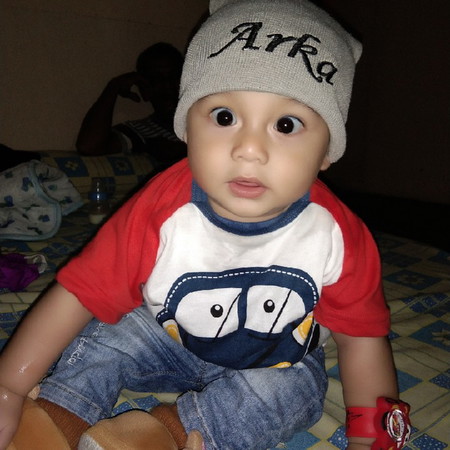 Putih dipipi bekas asi