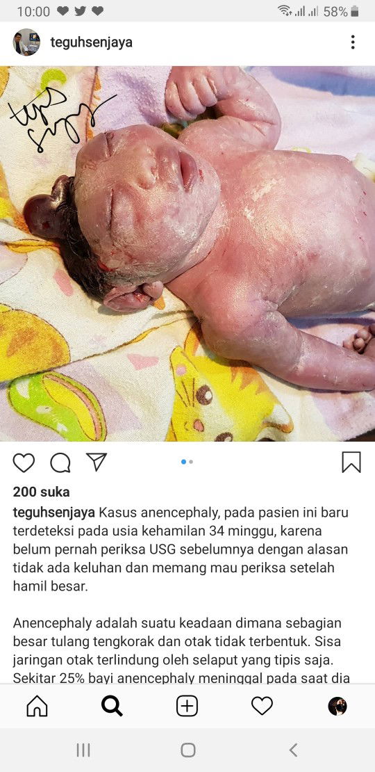MAU USG KALO SUDAH BESAR AJA, KARNA GAPERNAH ADA KELUHAN...BACA YAA