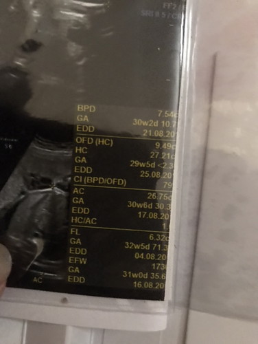 Binggung dg usia kehamilan