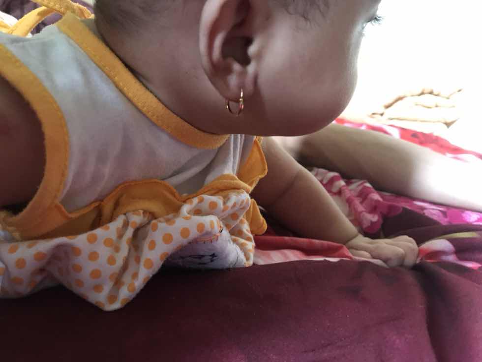 Borok di lubang anting bayi