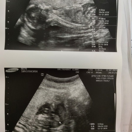 แบบนี้ ผช ชัวรไหม