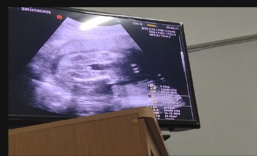 ลูก ผช ชัวรใช่ไหมค่ะ