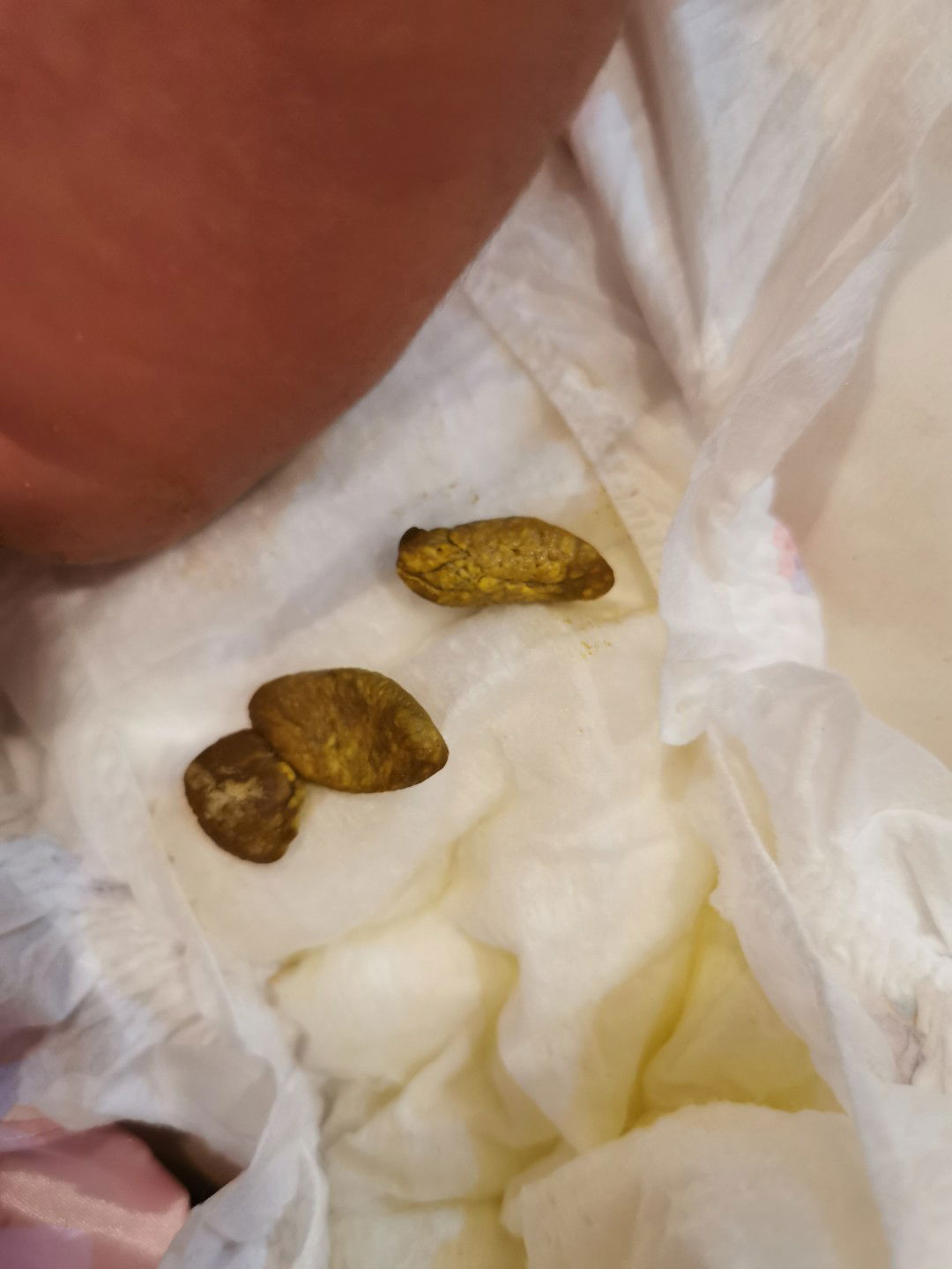 อึกของลูก