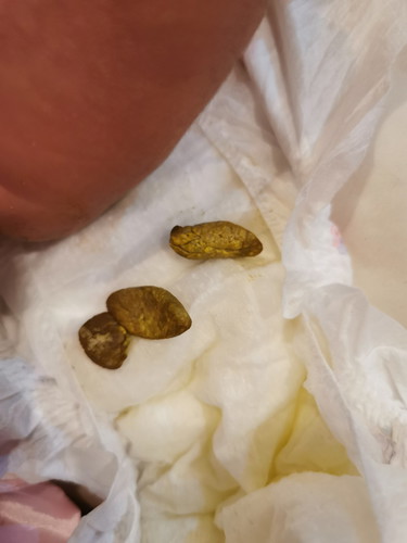 อึกของลูก