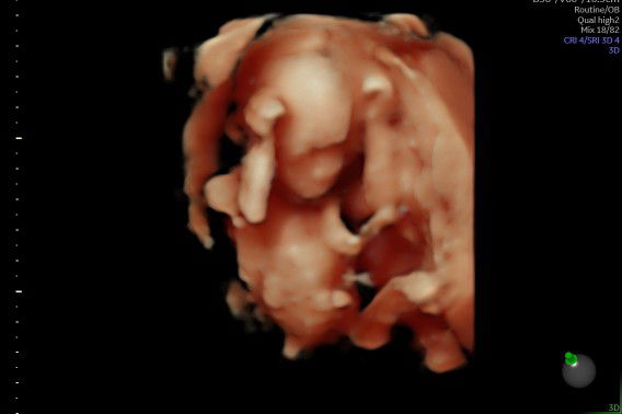 Chelsi Aulia profile icon