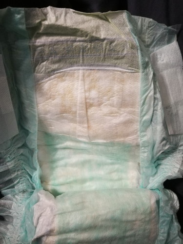 Yellowing of Chicco Diapers