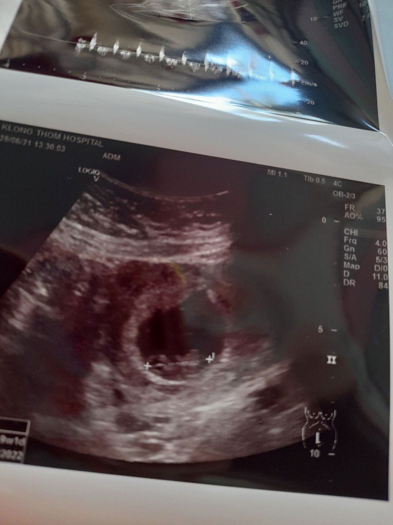 Sirinat Mon Ice profile icon