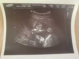 Alyanna R. Chua profile icon