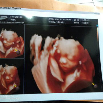 Trisa Susanti profile icon