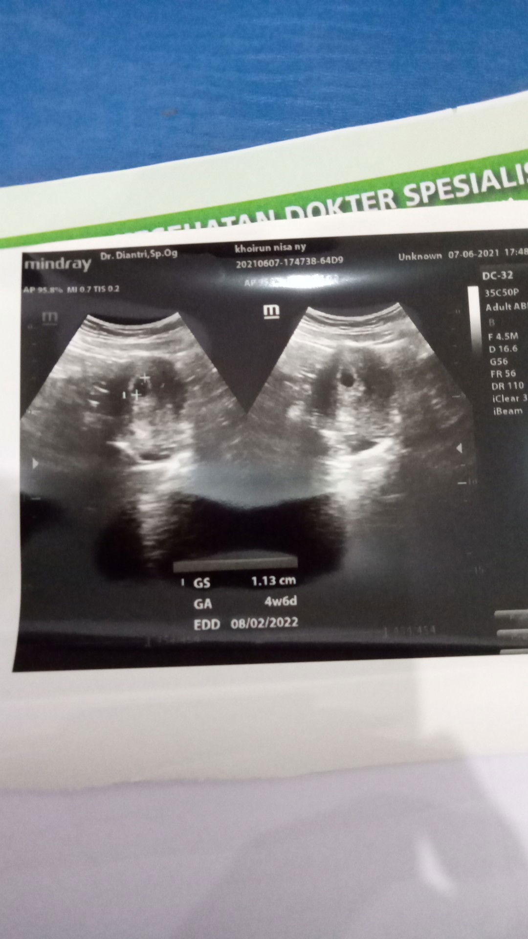 Khoirun Nissa profile icon