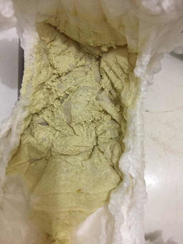 ท้องเสีย