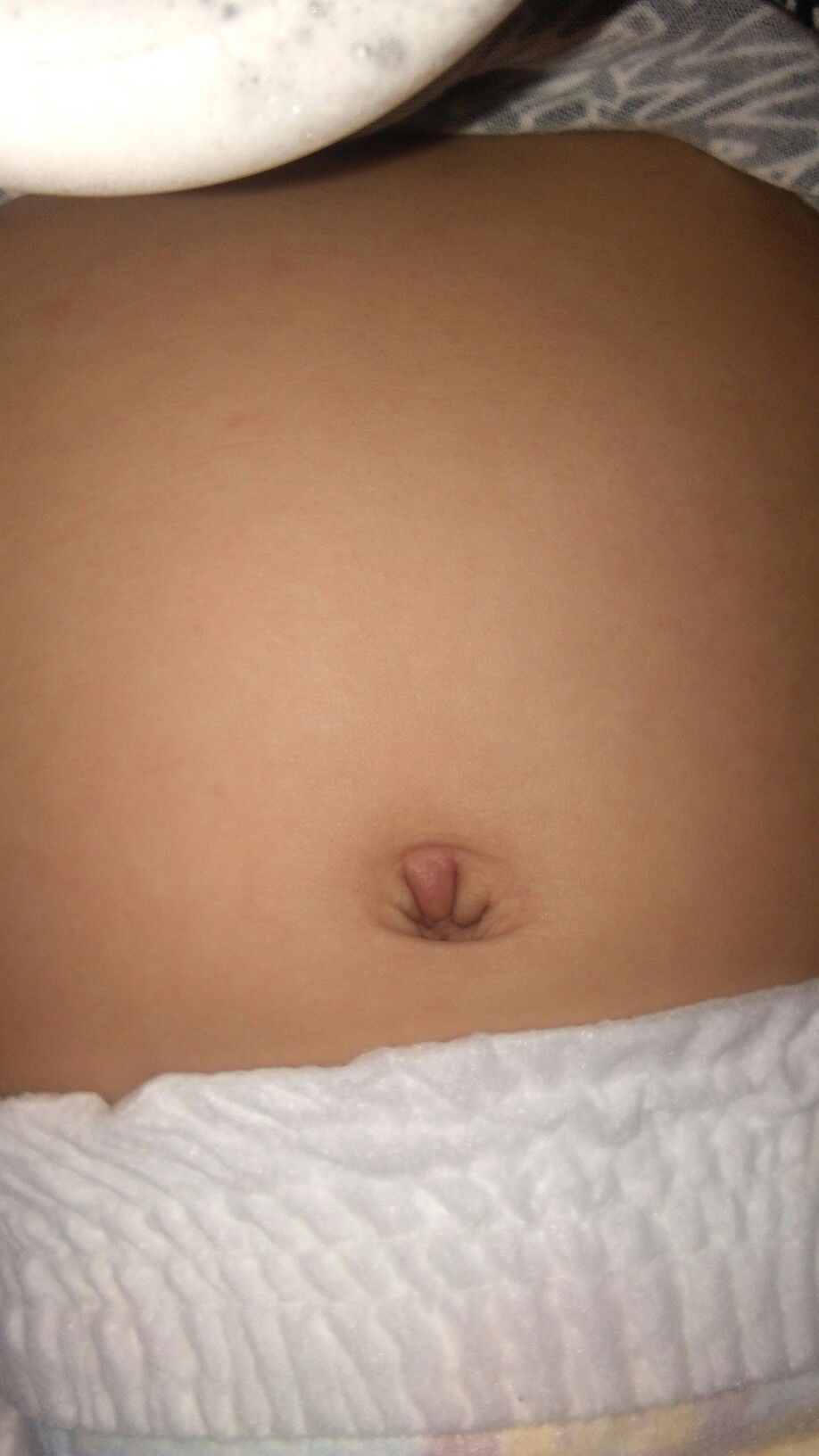 Rashes on a 10-Months-Old