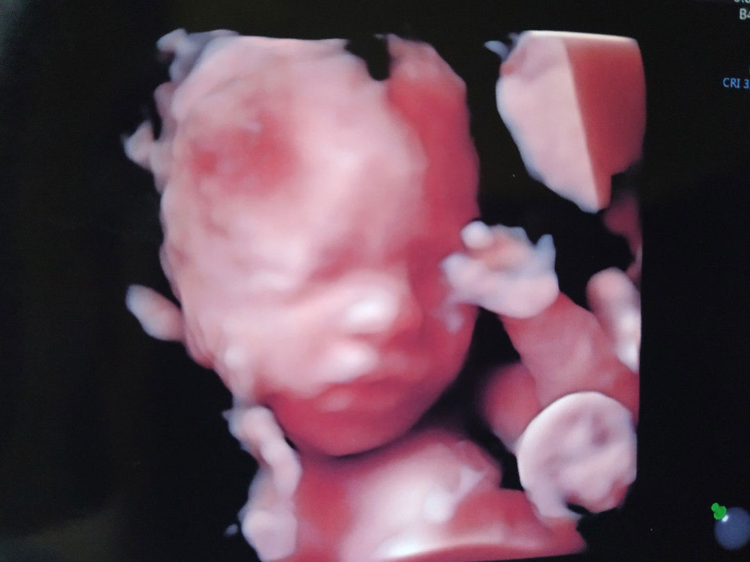 Trisula Melati profile icon