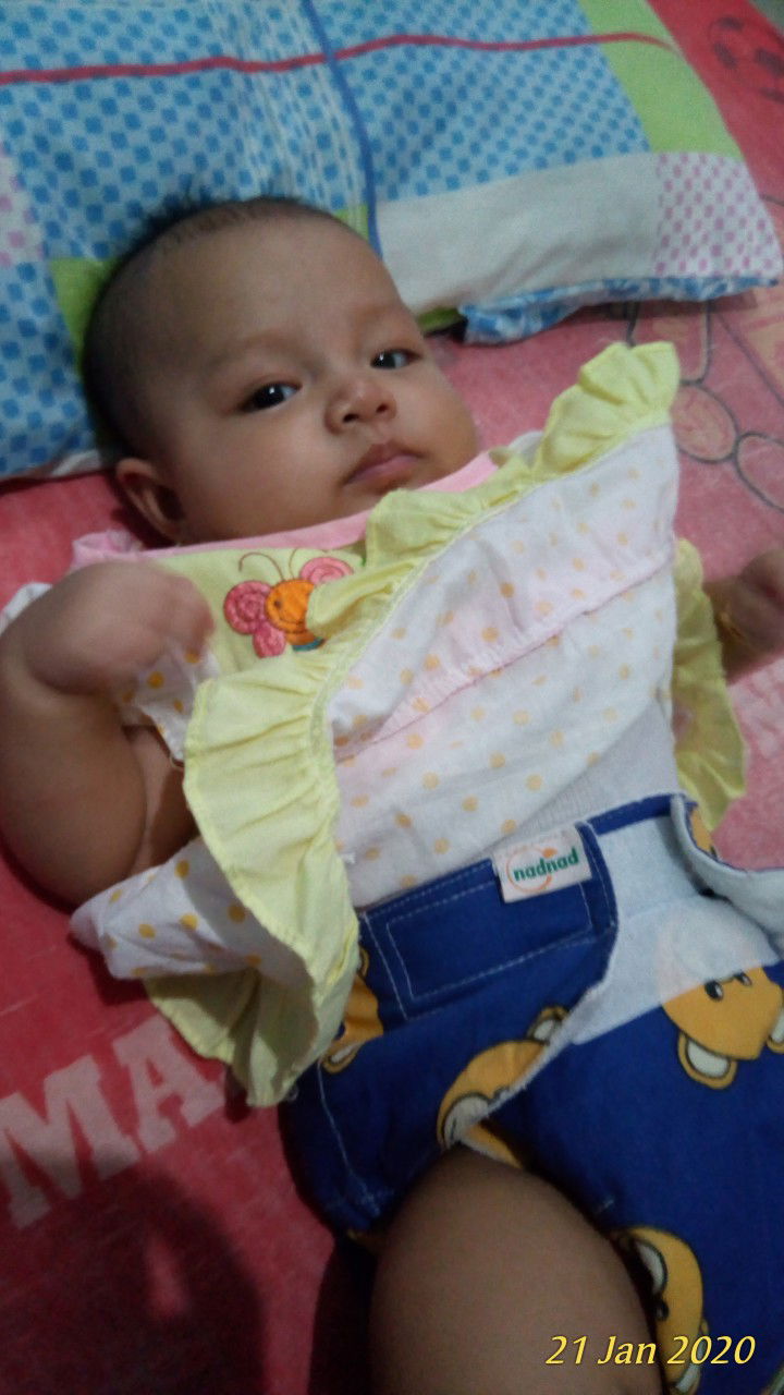 bayi 4bulan buang air besar