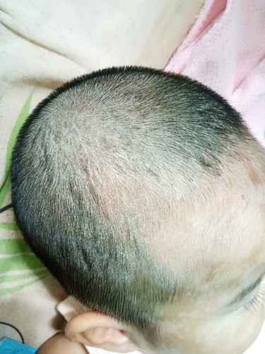 เชื้อรา