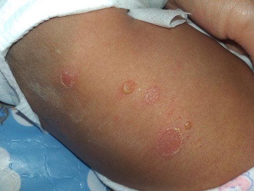 แพ้หรือเปนอะไรหรอคะ