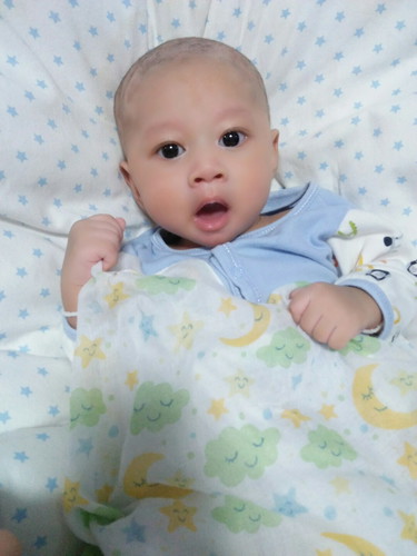 ขอเสียงคนหัวโล้นหน่อยครับบบ