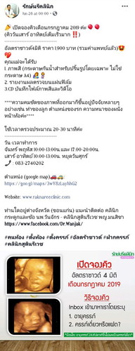 อัลตราซาวด์ 4 มิติ