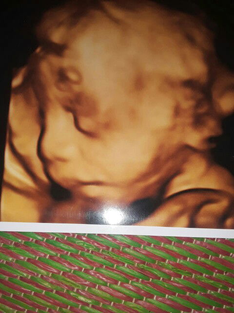 Dhuwy Ninik Dhuwie profile icon