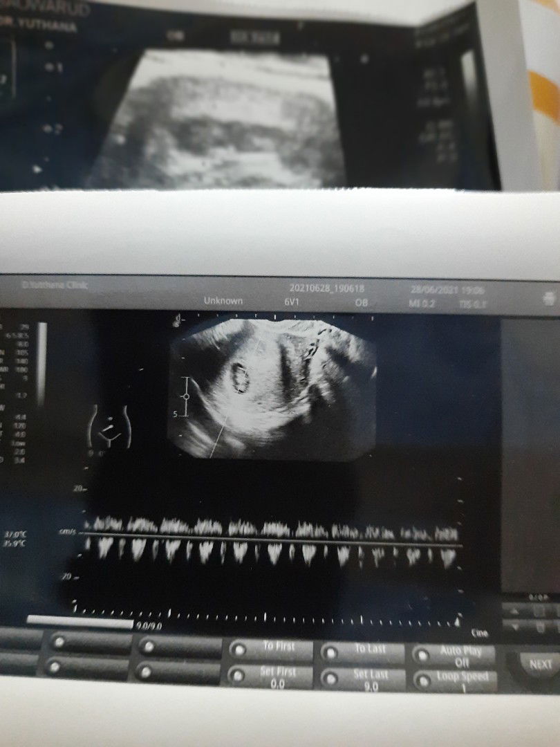 รัตน์ profile icon