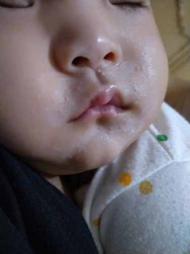 merintis di bagian sebelah mulut