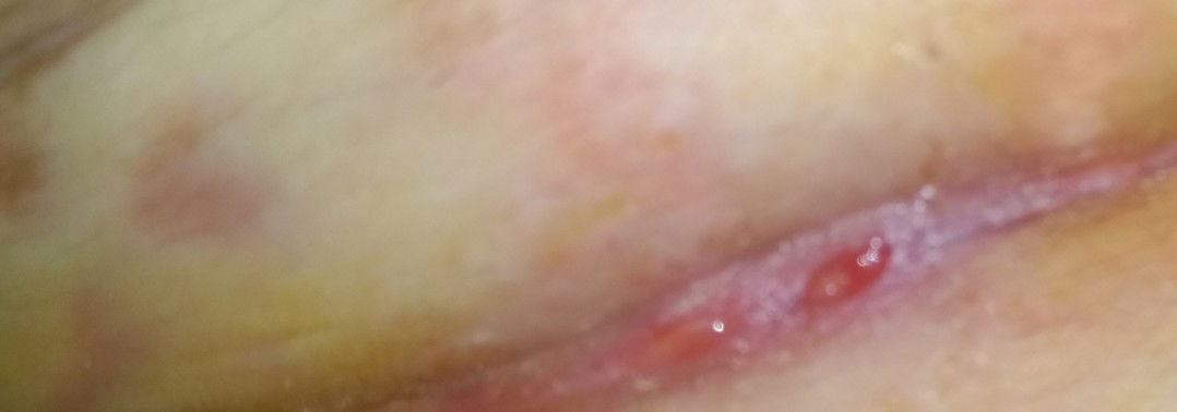 Bernanah Setelah Sesar